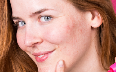 Gesicht mit Mischhaut