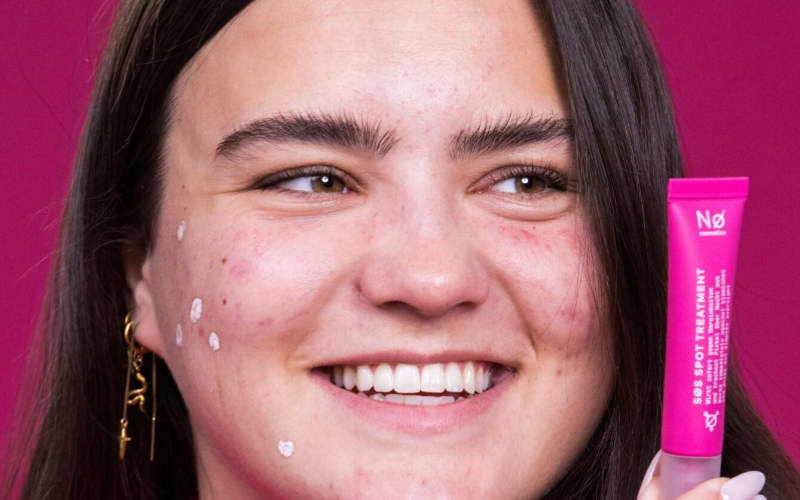 Person hält das SØS Spot Treatment von Nø Cosmetics